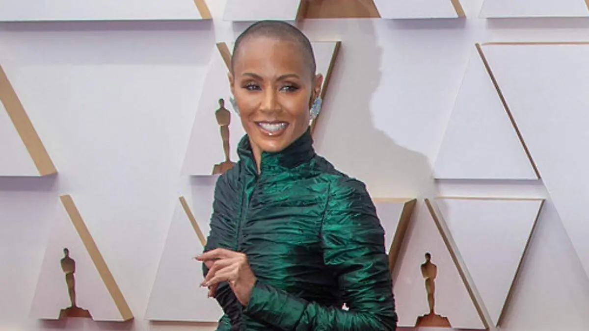 ALOPECIA Jada Pinkett Smith2